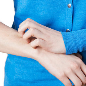 Treating Dry Skin