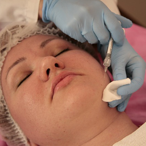 Dermal Fillers: How They Work to Correct Wrinkles