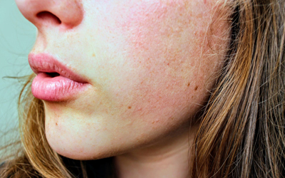 Breakouts