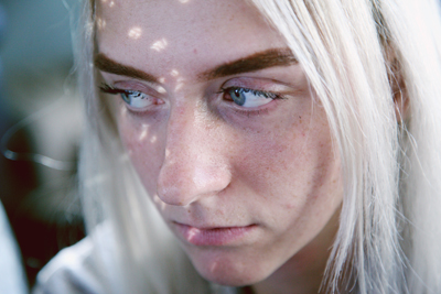 Acne Face Mapping