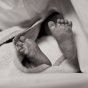 Baby Skin Conditions