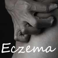 How to Identify Eczema