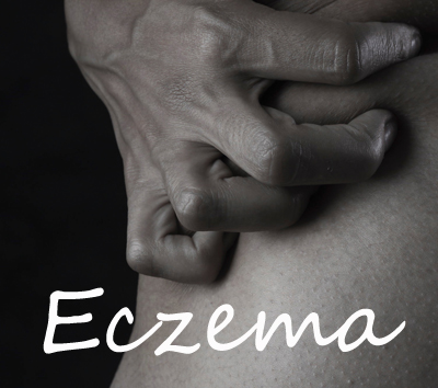 How to Identify Eczema