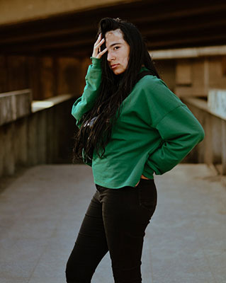 Vitiligo