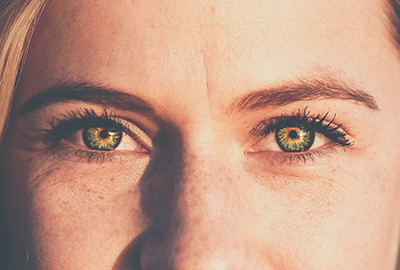 Under eye wrinkles