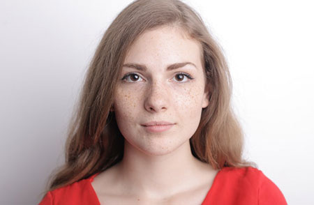 Brown spots on woman's face