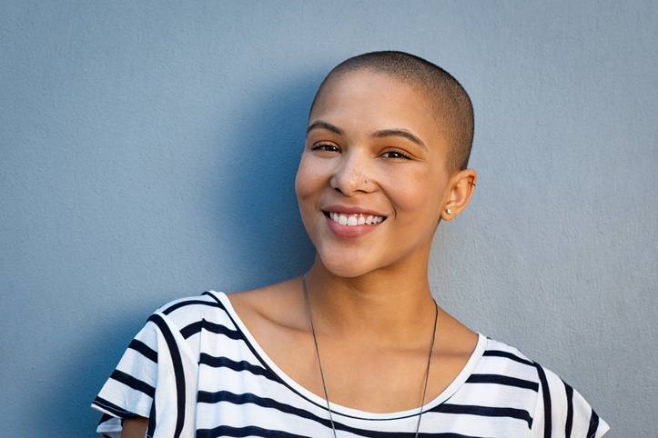 Female suffering from alopecia