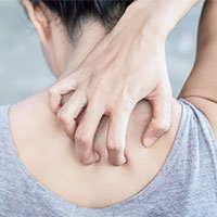 Does Skin Cancer Itch