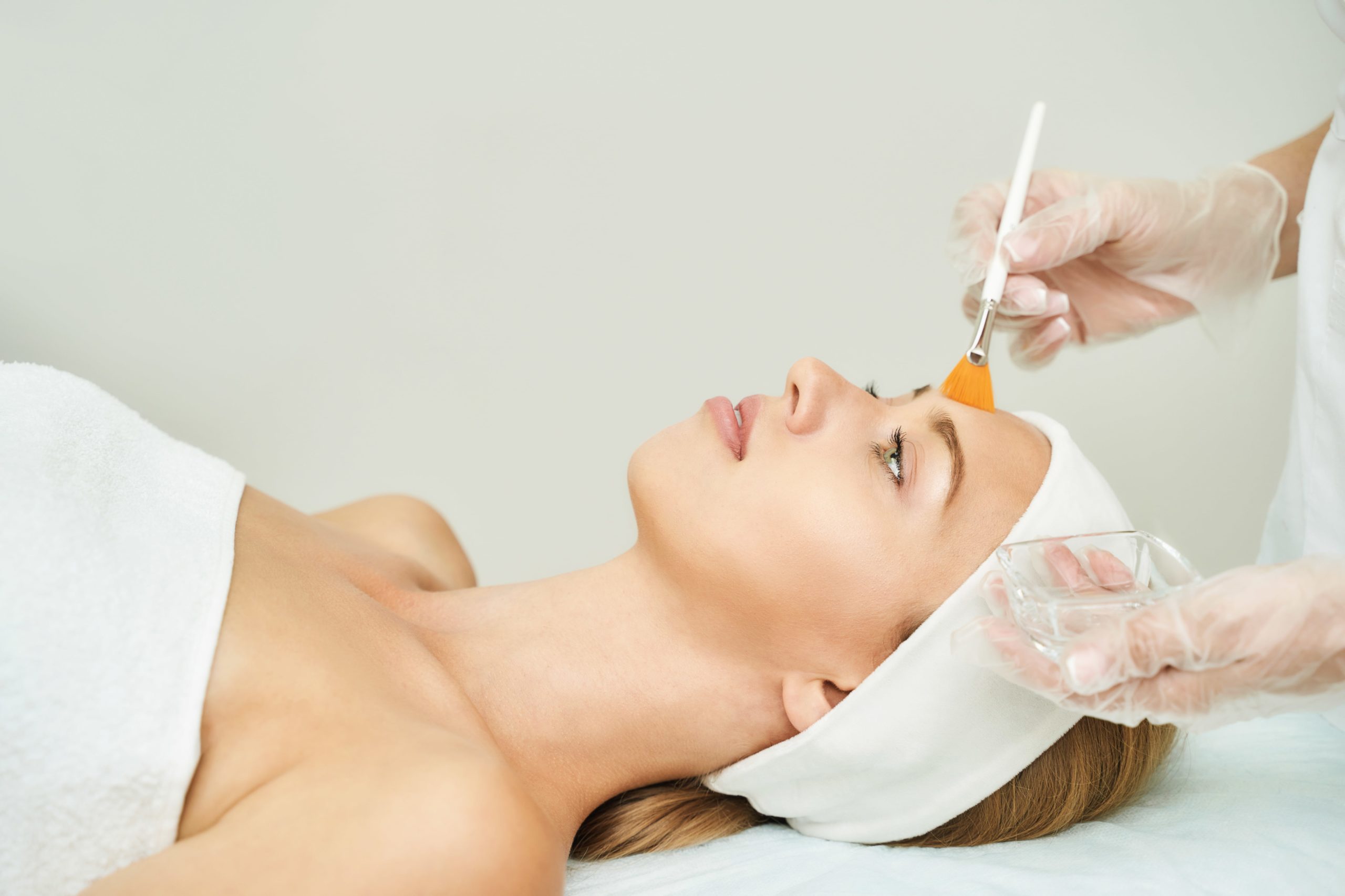 Chemical Peels