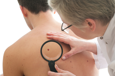 Skin Cancer & Treatments