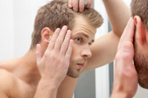 Handsome young man worried about hairloss