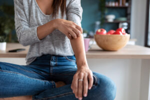woman sitting at her counter while itching her eczema during fall season
