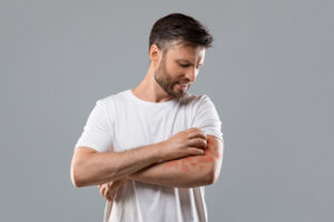 man scratching his rash wondering if it's eczema or psoriasis