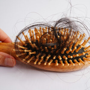 hair brush full on a table representing hair loss