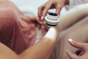 The dermatologist examines the moles or acne of the patient with a dermatoscope, signifying the difference between a med spa and dermatologist.