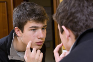 young man looking in the mirror as he struggles with teen acne triggers