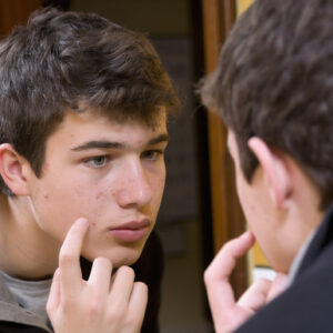young man looking in the mirror as he struggles with teen acne triggers