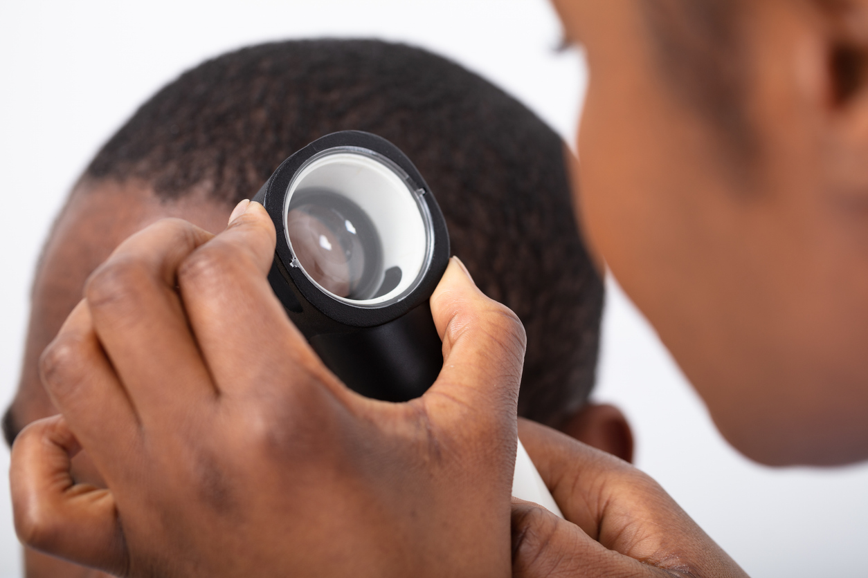 dermatologist looking through a dermatoscope at the scalp of a young man while examining for skin cancer on the scalp