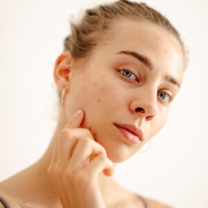 closeup of a woman looking at her face as she wonders how to prevent acne before her period
