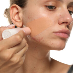 Close-up of young woman applying foundation on acne-prone skin, studio shot on white background.