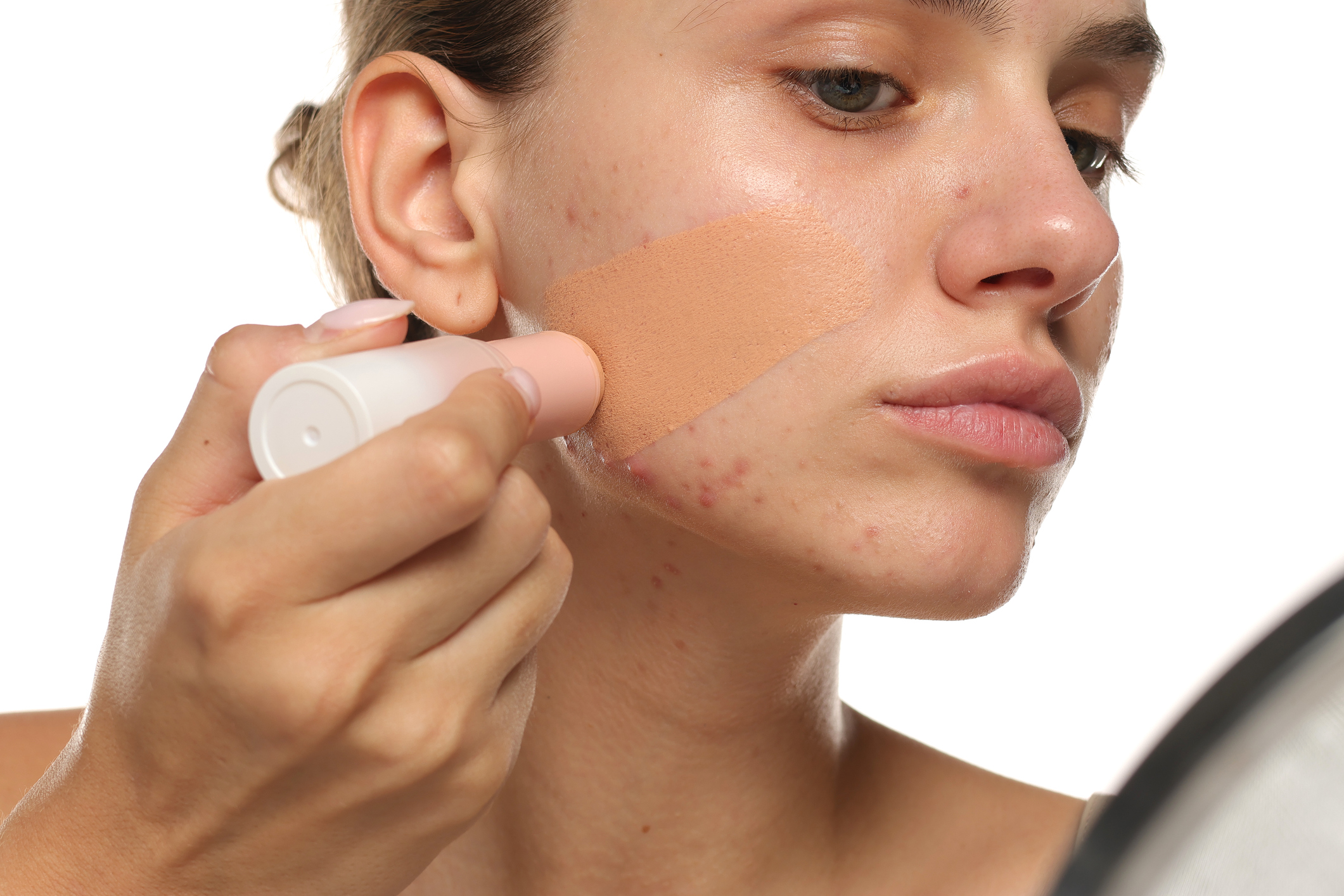 Close-up of young woman applying foundation on acne-prone skin, studio shot on white background.