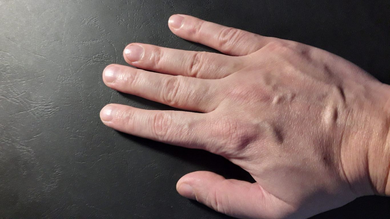 Hand of a man in various states on a black the background